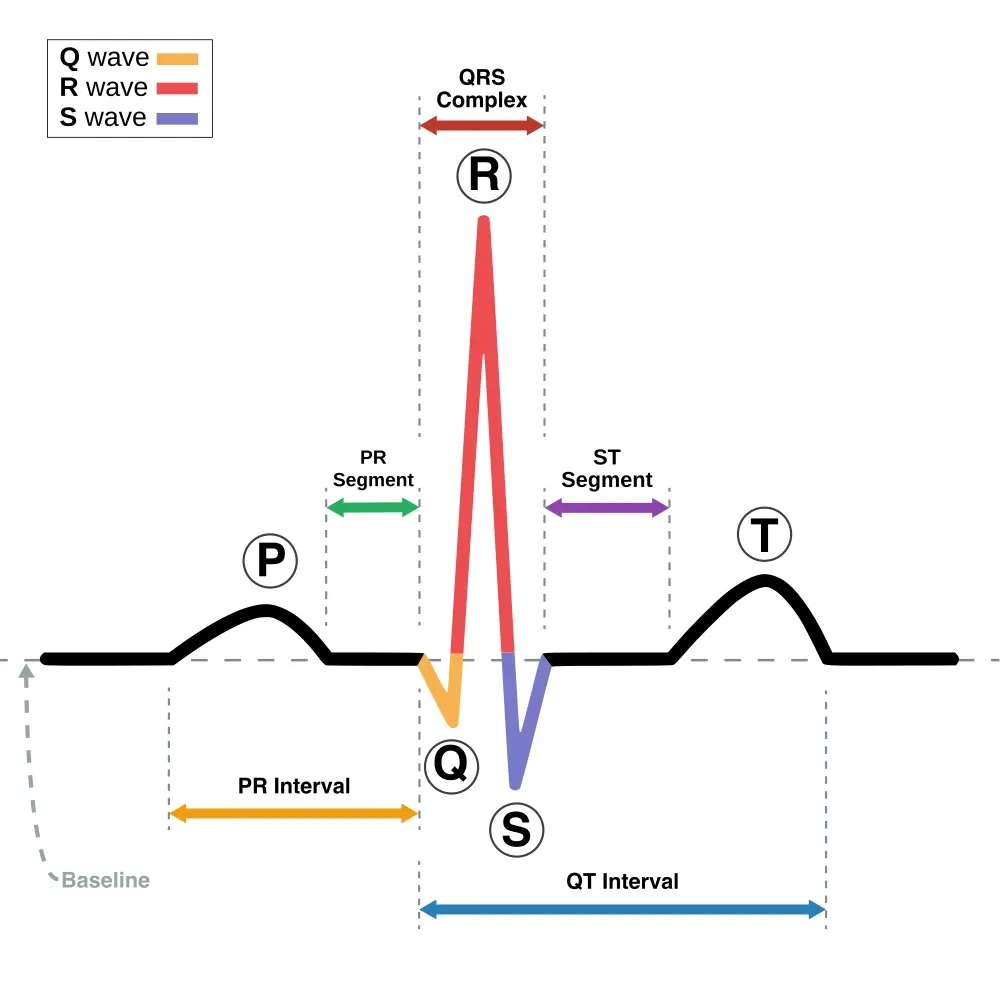 A labelled diagram of one heartbeat as traced on an ECG, marking the P wave, the QRS complex and the T wave, with brackets beneath showing the PR interval and the longer QT interval.