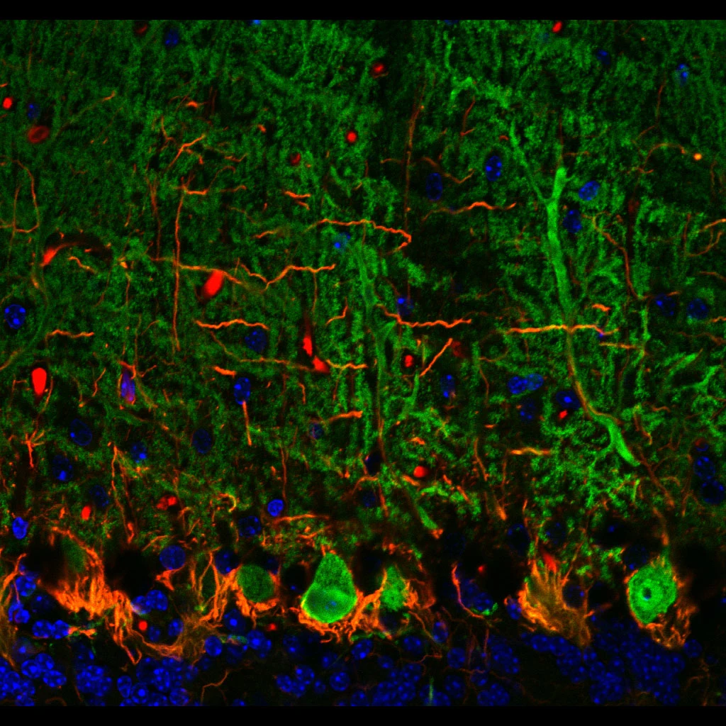 A fluorescence micrograph of mouse cerebellum. Large green cell bodies sit in a row along the lower third, each sending an elaborate branching tree upward through a dense green field. Orange fibres wrap the cell bodies and blue-stained nuclei crowd the layer beneath.