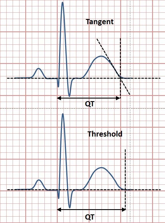Two ECG complexes drawn on grid paper, one above the other. In the upper one a tangent line is drawn down the steepest slope of the T wave to fix the end point; in the lower one the end point is taken where the T wave returns to the baseline. The QT bracket beneath each ends in a different place.